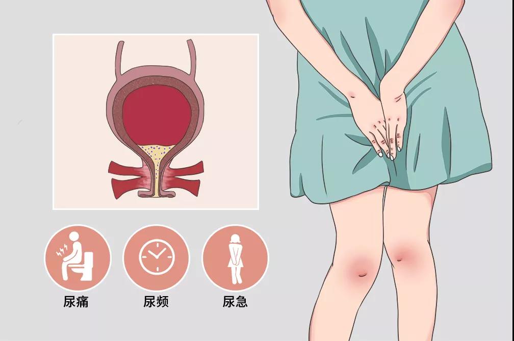 1639116675110415.jpg 1639116675110415.jpg